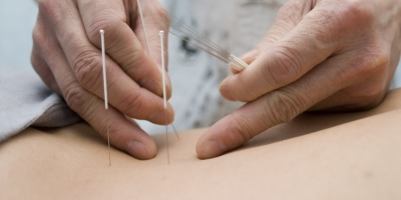 Akupunktur ve Uygulama Alanları