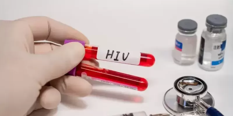 What is AIDS/HIV infection? How is it transmitted? How is it treated?