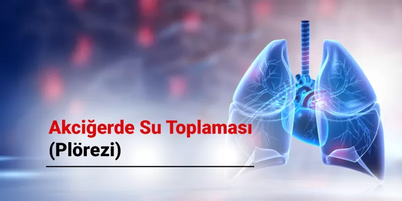 Akciğerde Su Toplaması (Plörezi): Belirtileri, Nedenleri ve Tedavi Yöntemleri