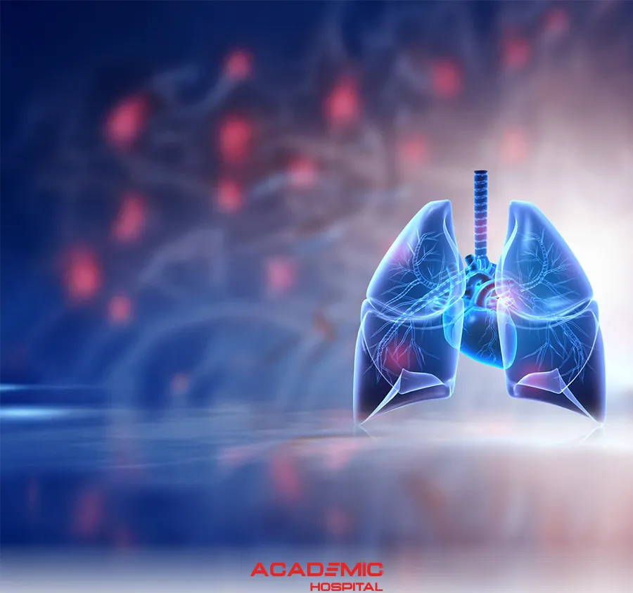 Fluid Accumulation in the Lungs (Pleurisy): Symptoms, Causes, and Treatment Methods
