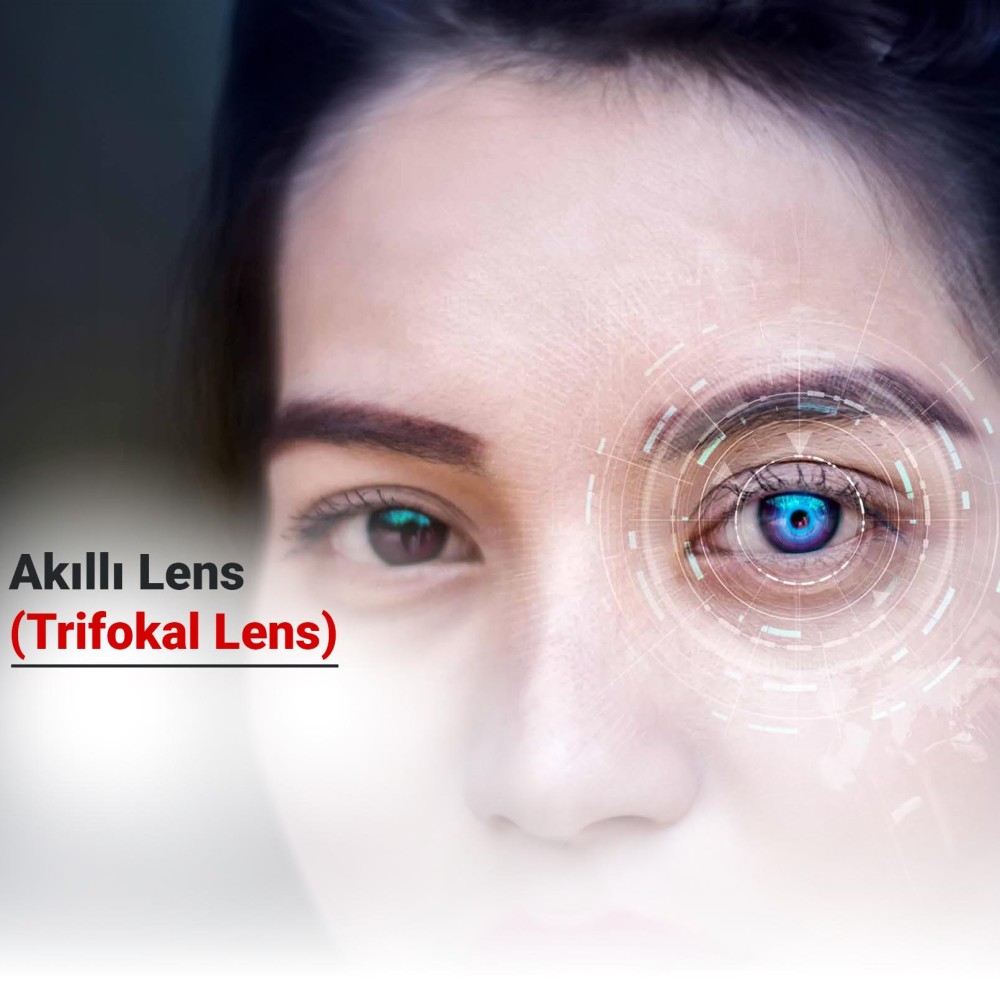 Akıllı Lens (Trifokal Lens) Nedir? Avantajları Nelerdir? Kimlere Uygulanabilir?