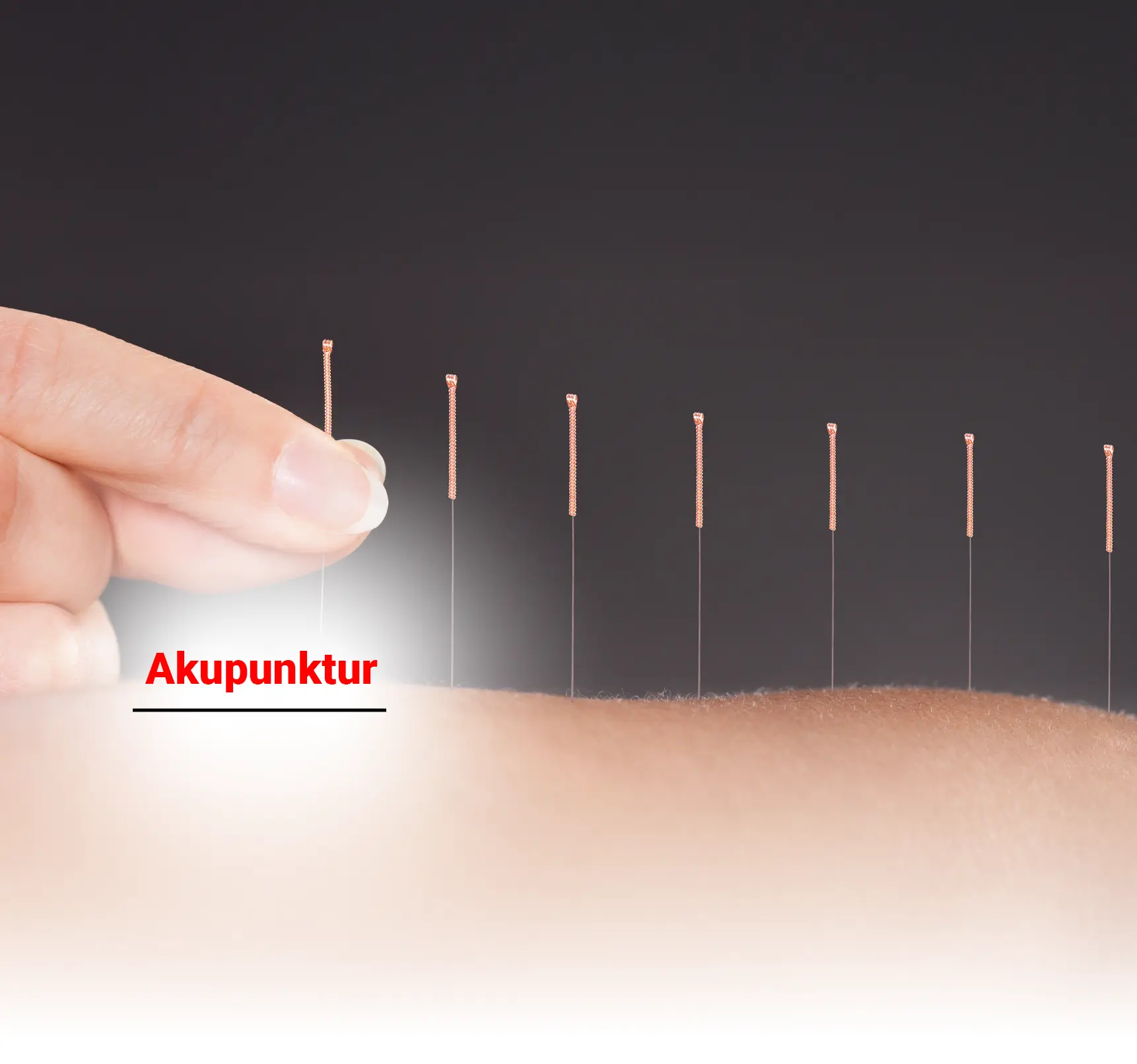 Akupunktur ve Uygulama Alanları