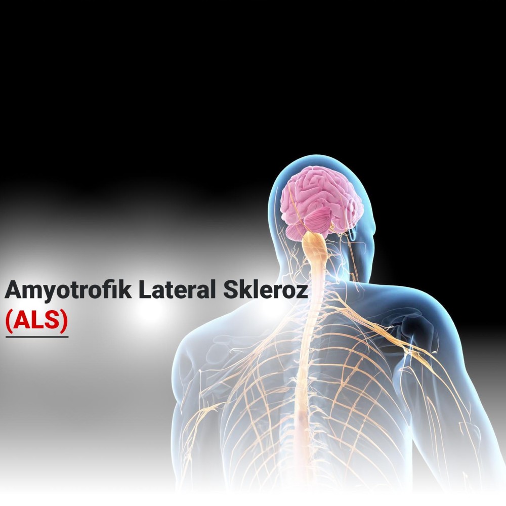 Amyotrofik Lateral Skleroz (ALS)