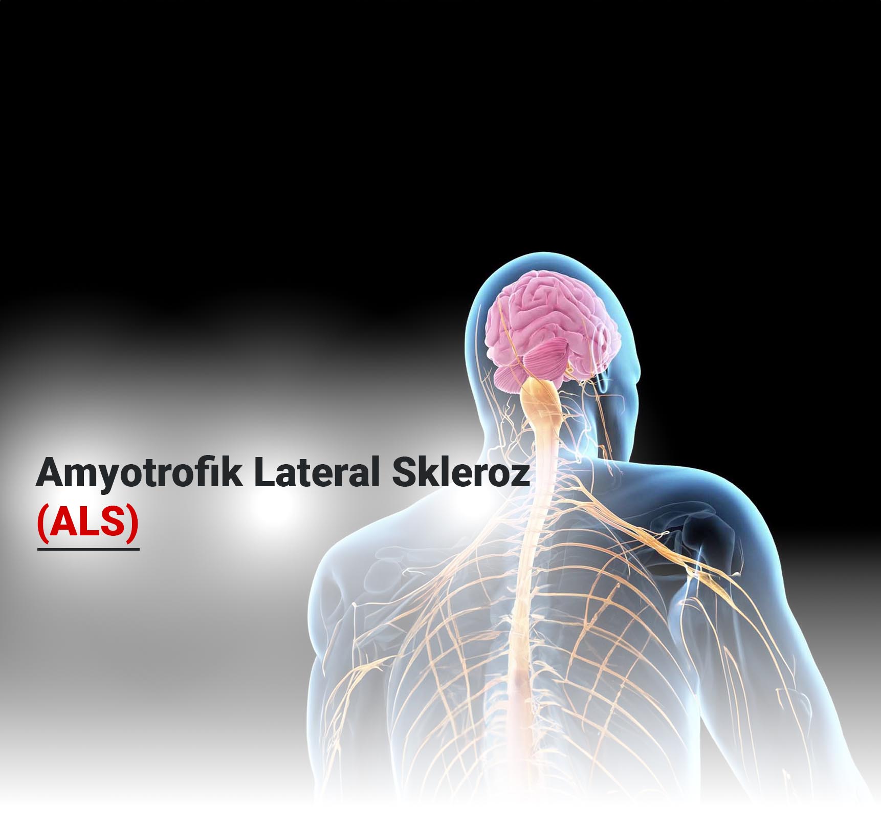 Amyotrofik Lateral Skleroz (ALS)