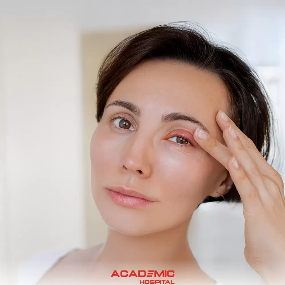 Arpacık (Göz Arpacığı) Nedir? Belirtileri ve Tedavi Yöntemleri Nelerdir?