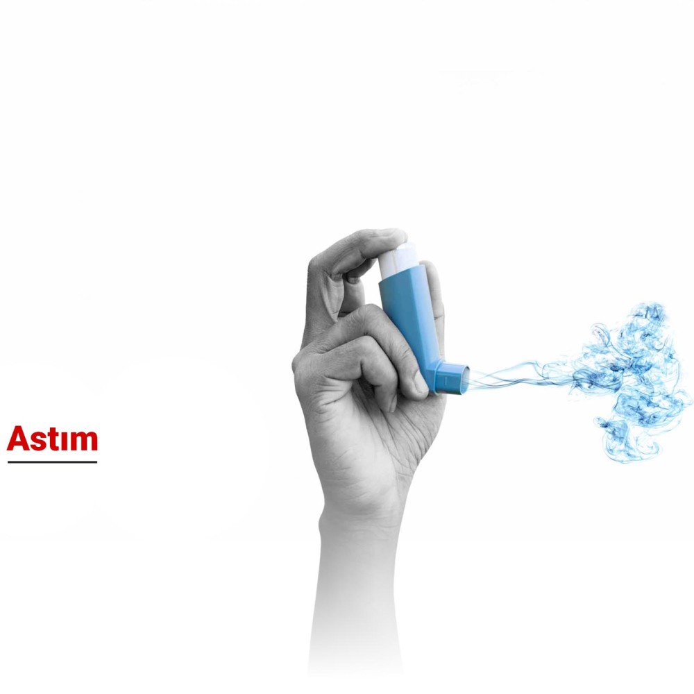 Solunum Yolları Hastalığı: Astım