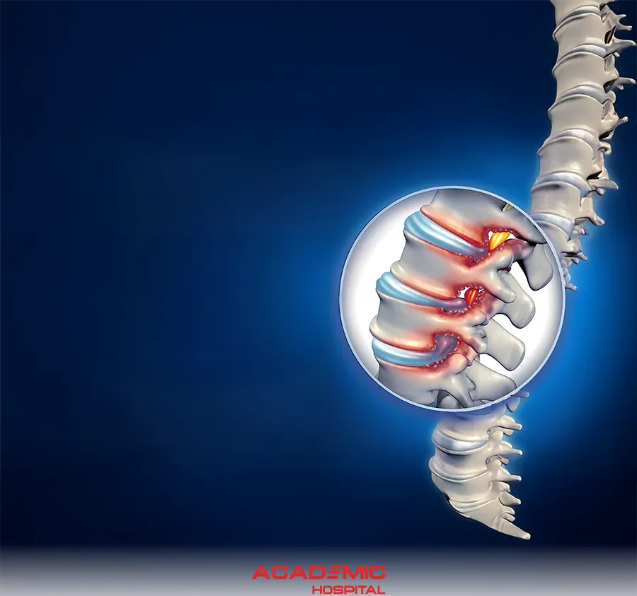 What Is Lumbar Spinal Stenosis? Symptoms, Causes, and Treatment Methods