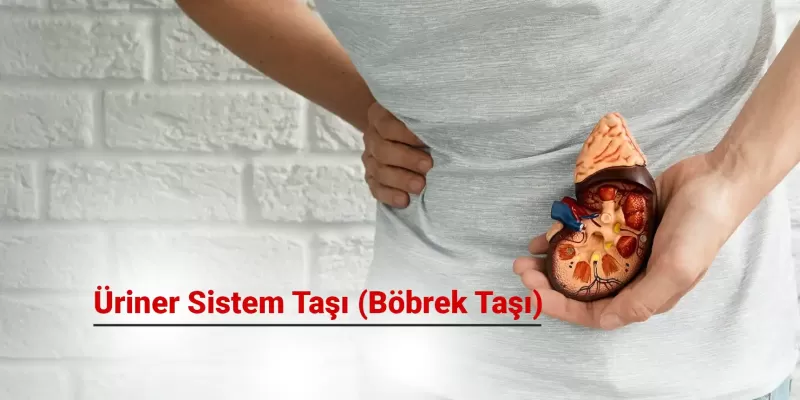 Üriner Sistem Taşları Neden Oluşur? Nasıl Tedavi Edilir?