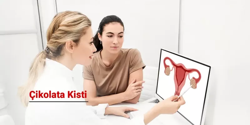 Çikolata Kisti (Endometriozis) Nedir? Belirtileri, Nedenleri ve Tedavi Yöntemleri Nelerdir?