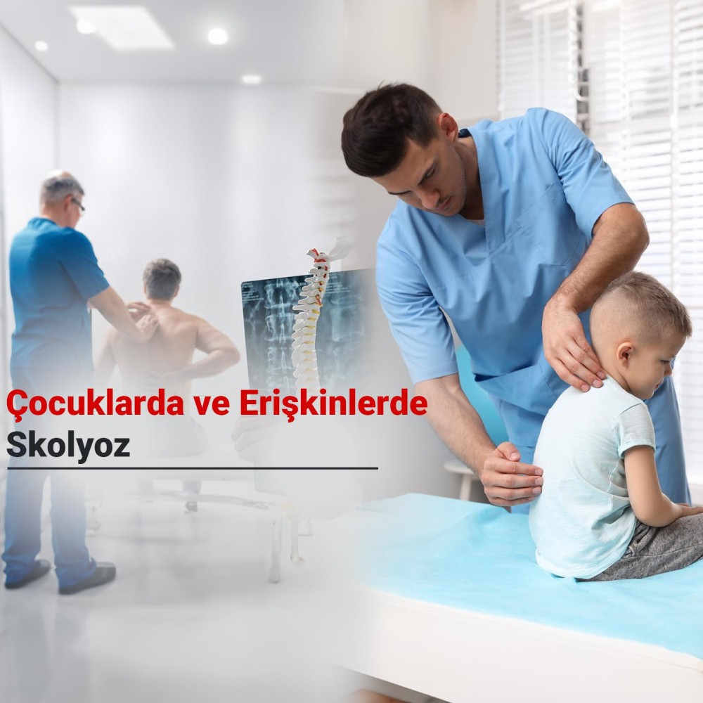 Skolyoz Nedir? Çocuklarda ve Erişkinlerde Skolyoz