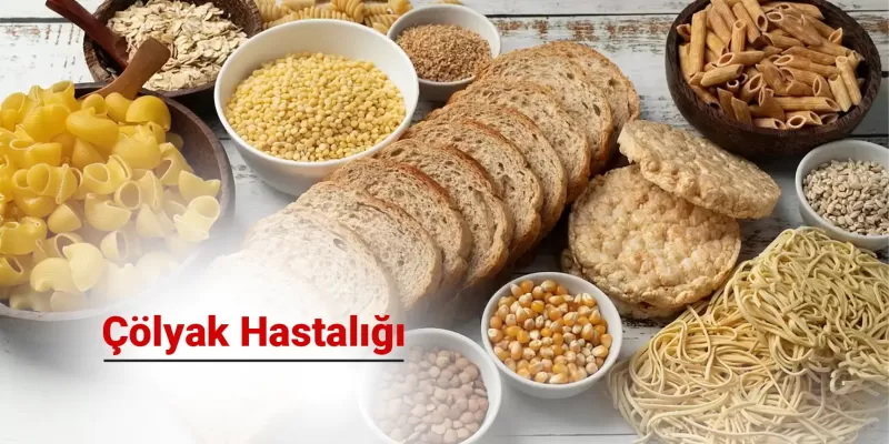 Çölyak Hastalığı Nedir? Belirtileri ve Tedavi Yöntemleri Nelerdir?