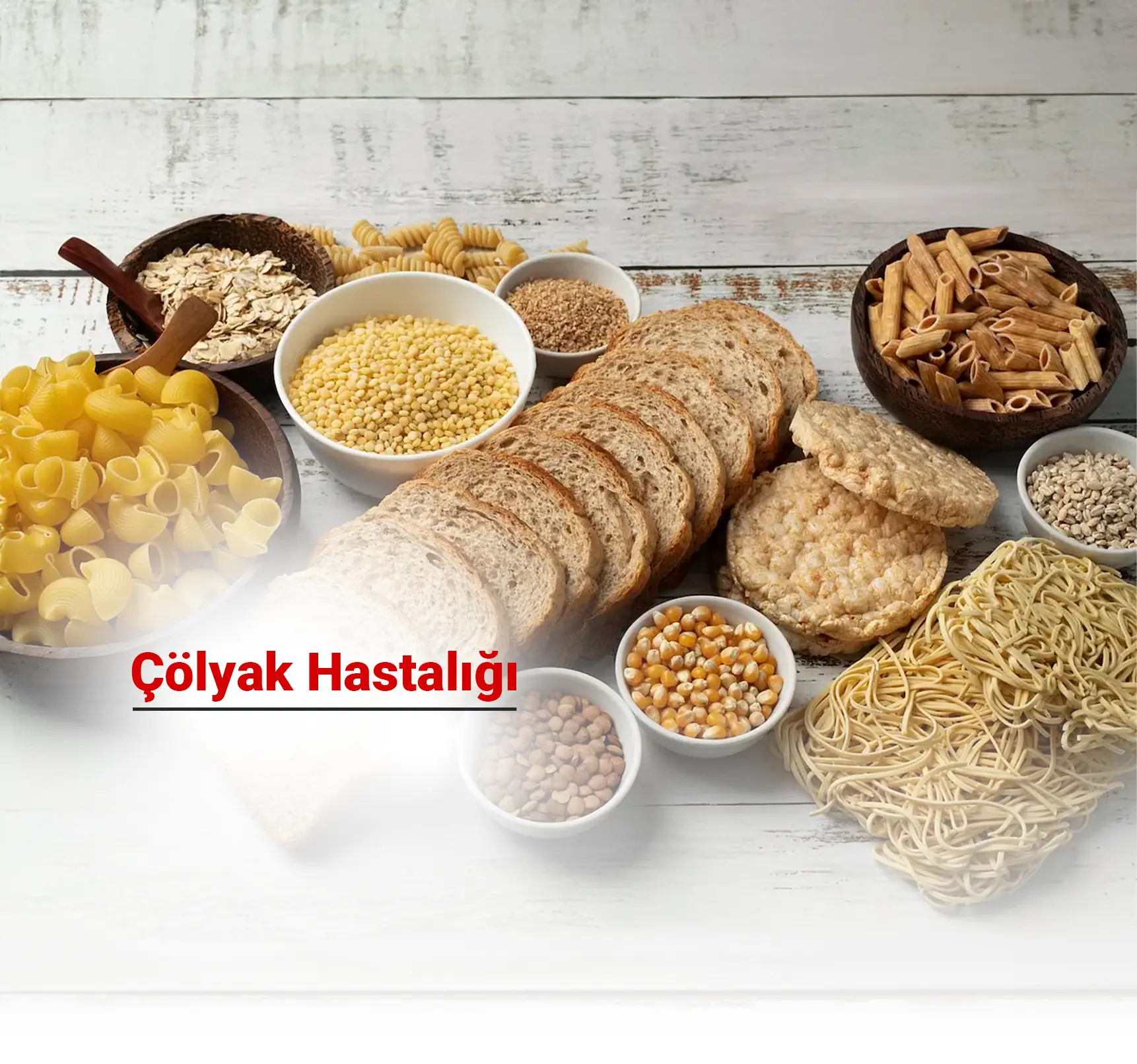 Çölyak Hastalığı Nedir? Belirtileri ve Tedavi Yöntemleri Nelerdir?