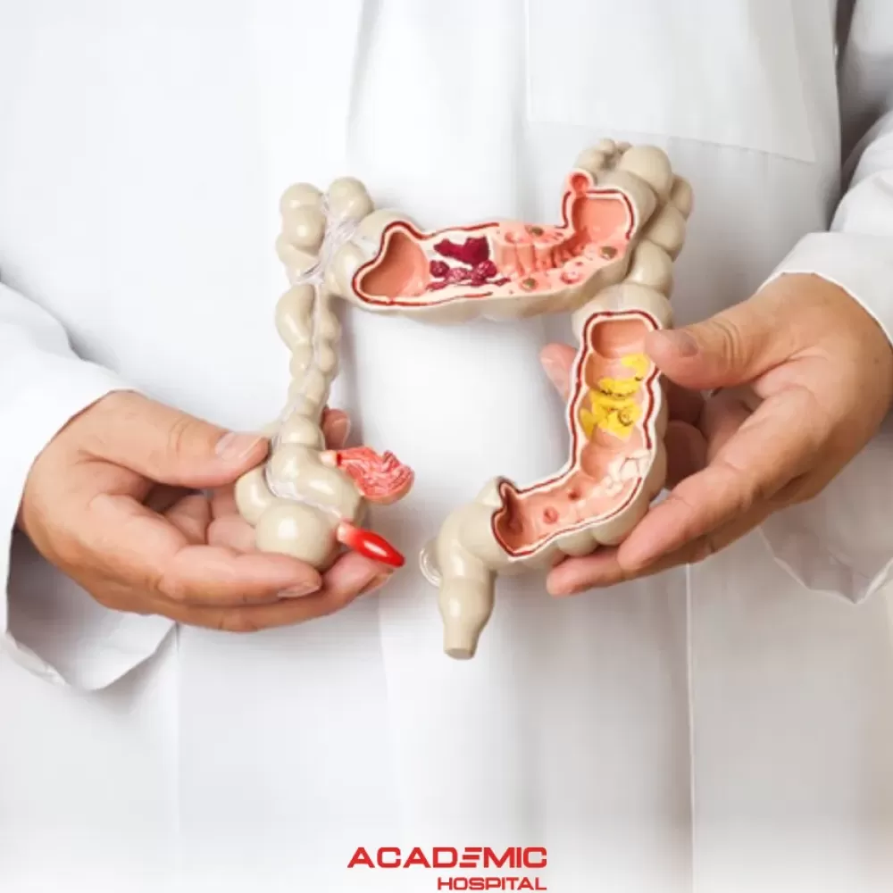 Crohn Hastalığı