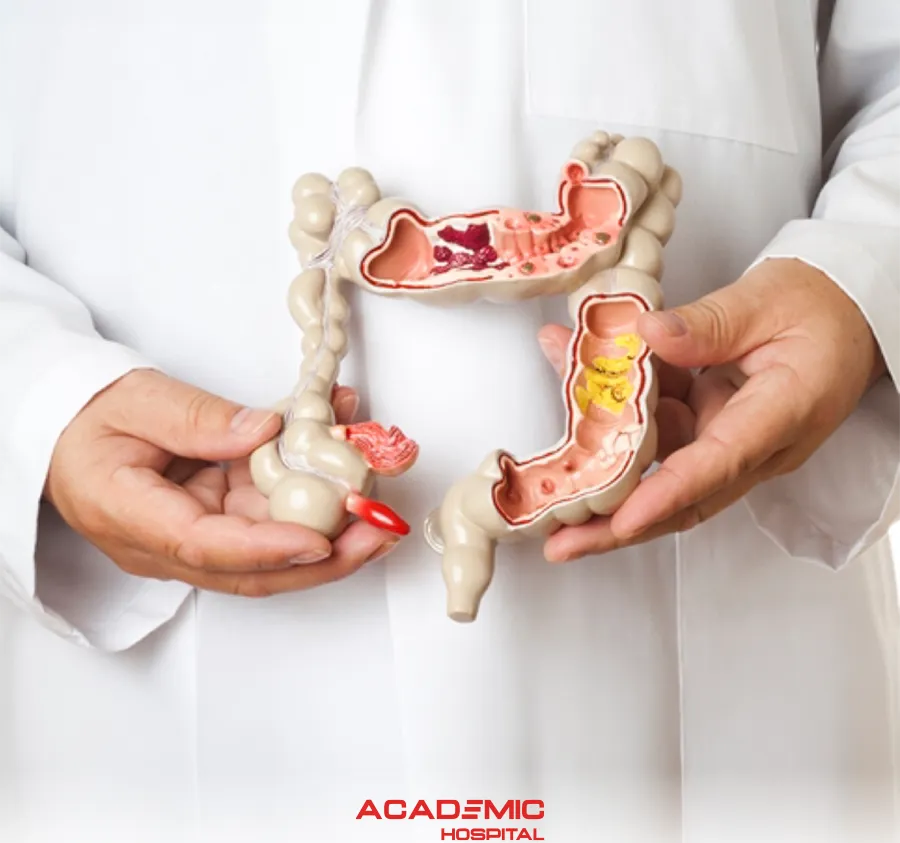 Crohn's Disease