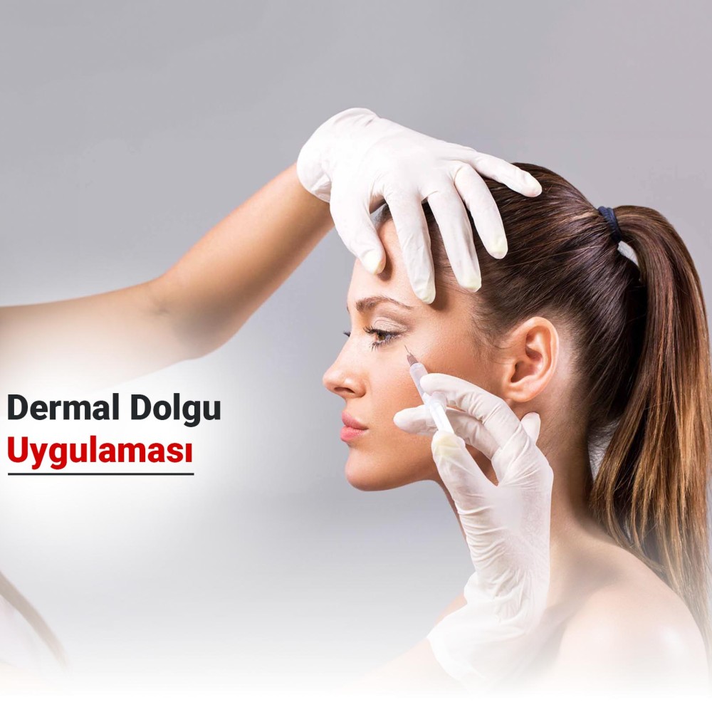 Dermal Dolgu Uygulaması Nedir? Nasıl Yapılmaktadır?
