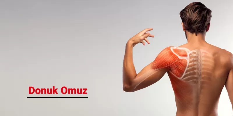 Donuk Omuz Nedir? Belirtileri, Nedenleri ve Tedavi Yöntemleri