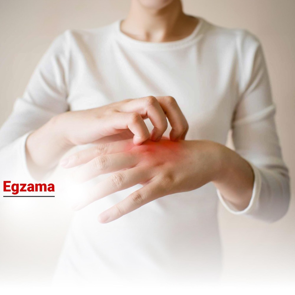 Egzama Nedir? Türleri, Belirtileri ve Tedavisi