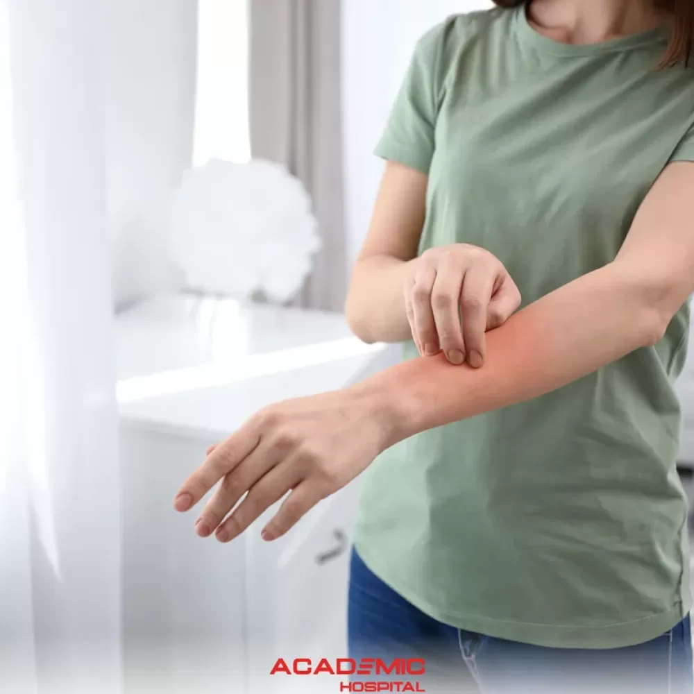 What Is Eczema? Types, Symptoms, and Treatment