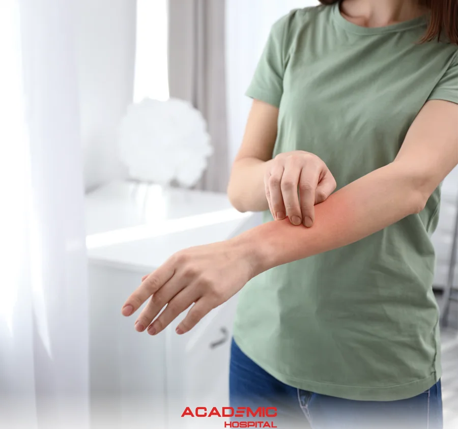 What Is Eczema? Types, Symptoms, and Treatment