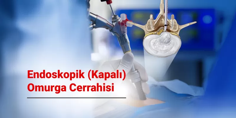 Endoskopik (Kapalı) Omurga Cerrahisi Nedir? Avantajları, Uygulama Alanları Nelerdir?