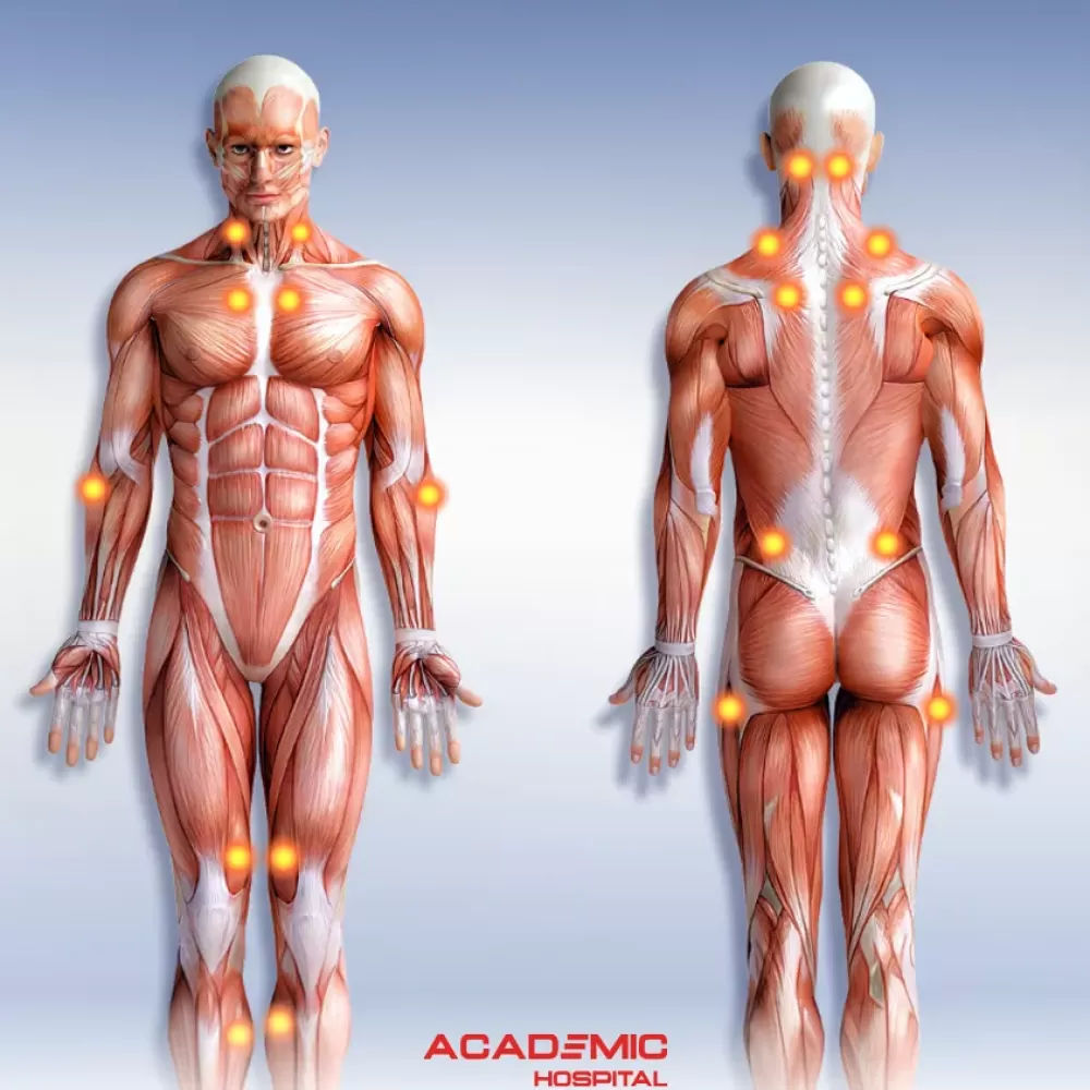 Fibromiyalji Nedir? Belirtileri Nelerdir? Tedavi Yöntemleri Nelerdir?