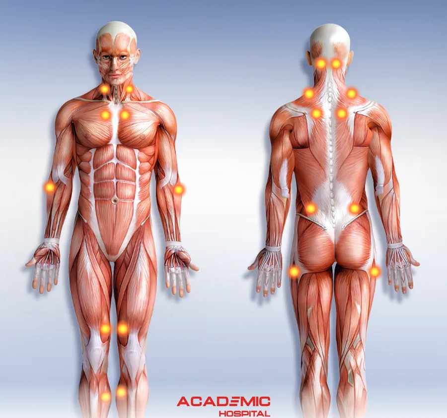 Fibromiyalji Nedir? Belirtileri Nelerdir? Tedavi Yöntemleri Nelerdir?