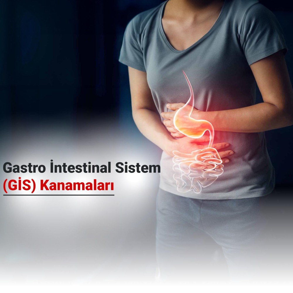 Gastro İntestinal Sistem (GİS) Kanamaları