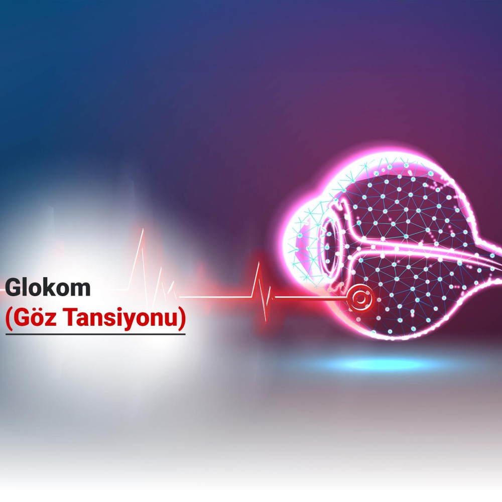 Glokom (Göz Tansiyonu) Nedir?