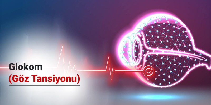 Glokom (Göz Tansiyonu) Nedir?