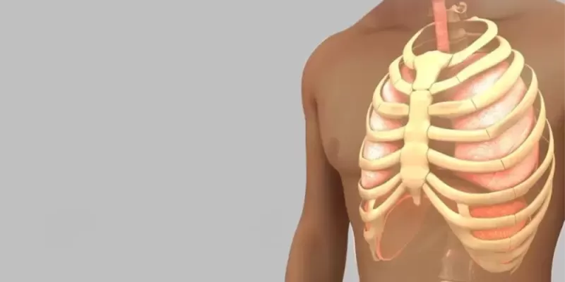 Göğüs Deformiteleri: Nedenleri, Belirtileri ve Tedavi Yöntemleri