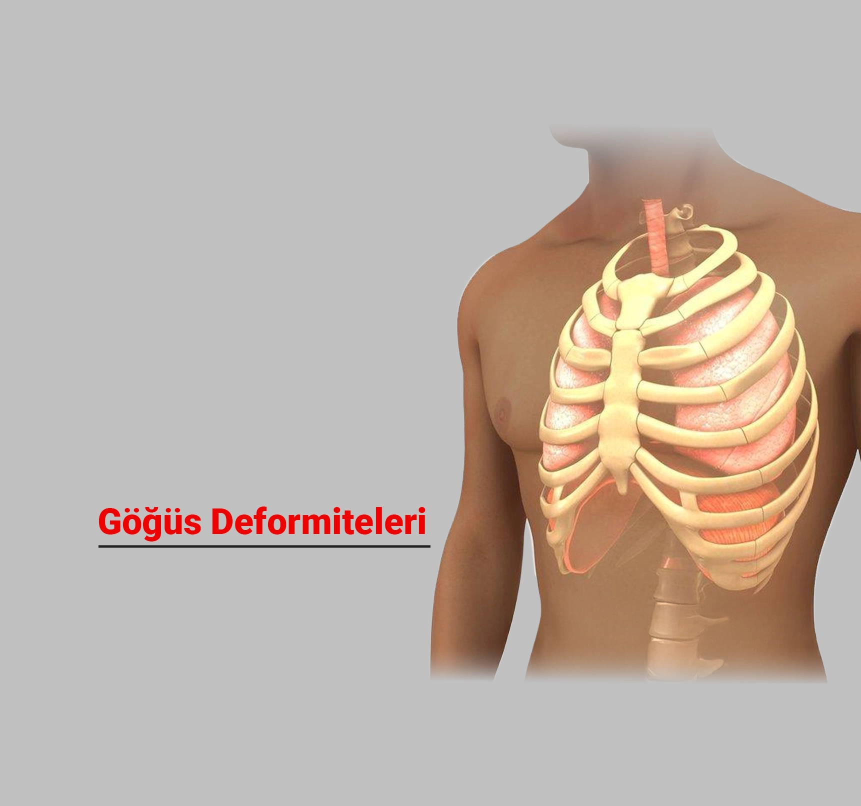 Göğüs Deformiteleri: Nedenleri, Belirtileri ve Tedavi Yöntemleri