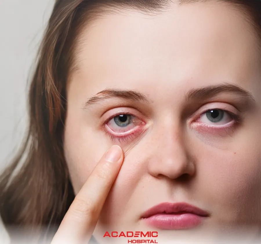 Gözde Et Büyümesi (Pterjium) Nedir? Belirtileri ve Tedavi Yöntemleri