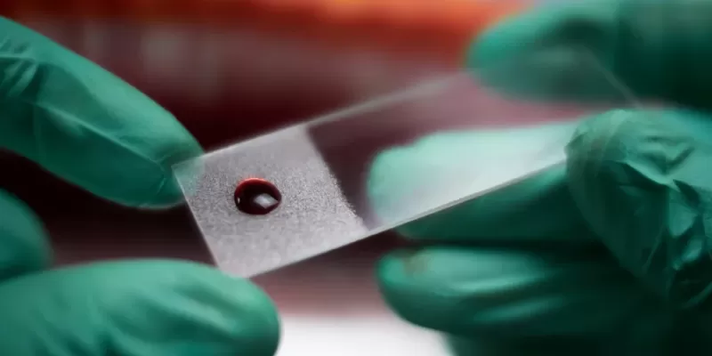 Hemogram: Complete Blood Count (CBC)
