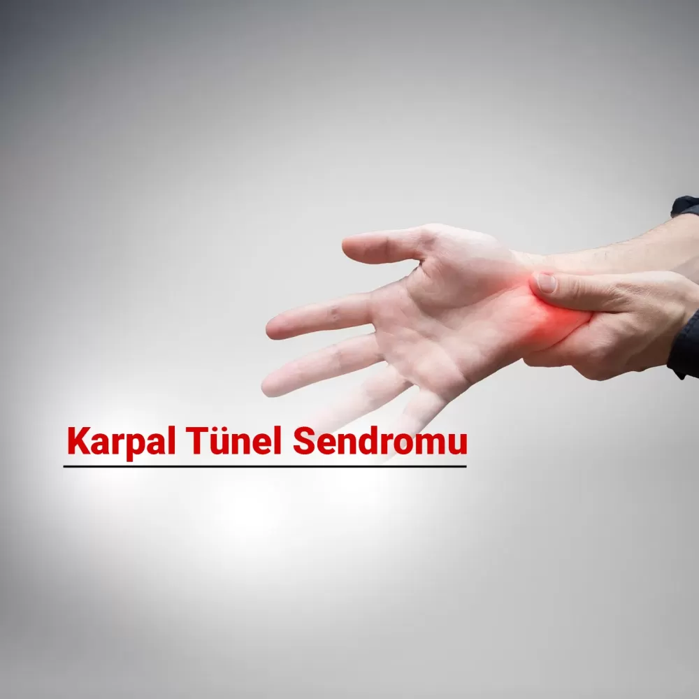 Karpal Tünel Sendromu Nedir? Belirtileri ve Tedavi Yöntemleri Nelerdir?