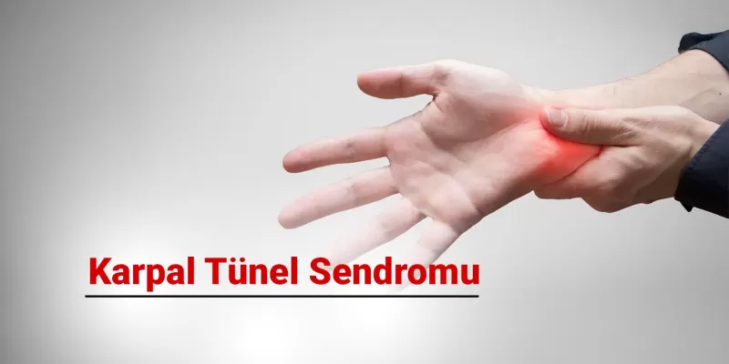 Karpal Tünel Sendromu Nedir? Belirtileri ve Tedavi Yöntemleri Nelerdir?