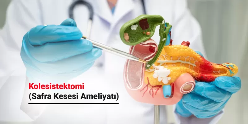 Kolesistektomi (Safra Kesesi Ameliyatı) Nedir? Neden Yapılır?