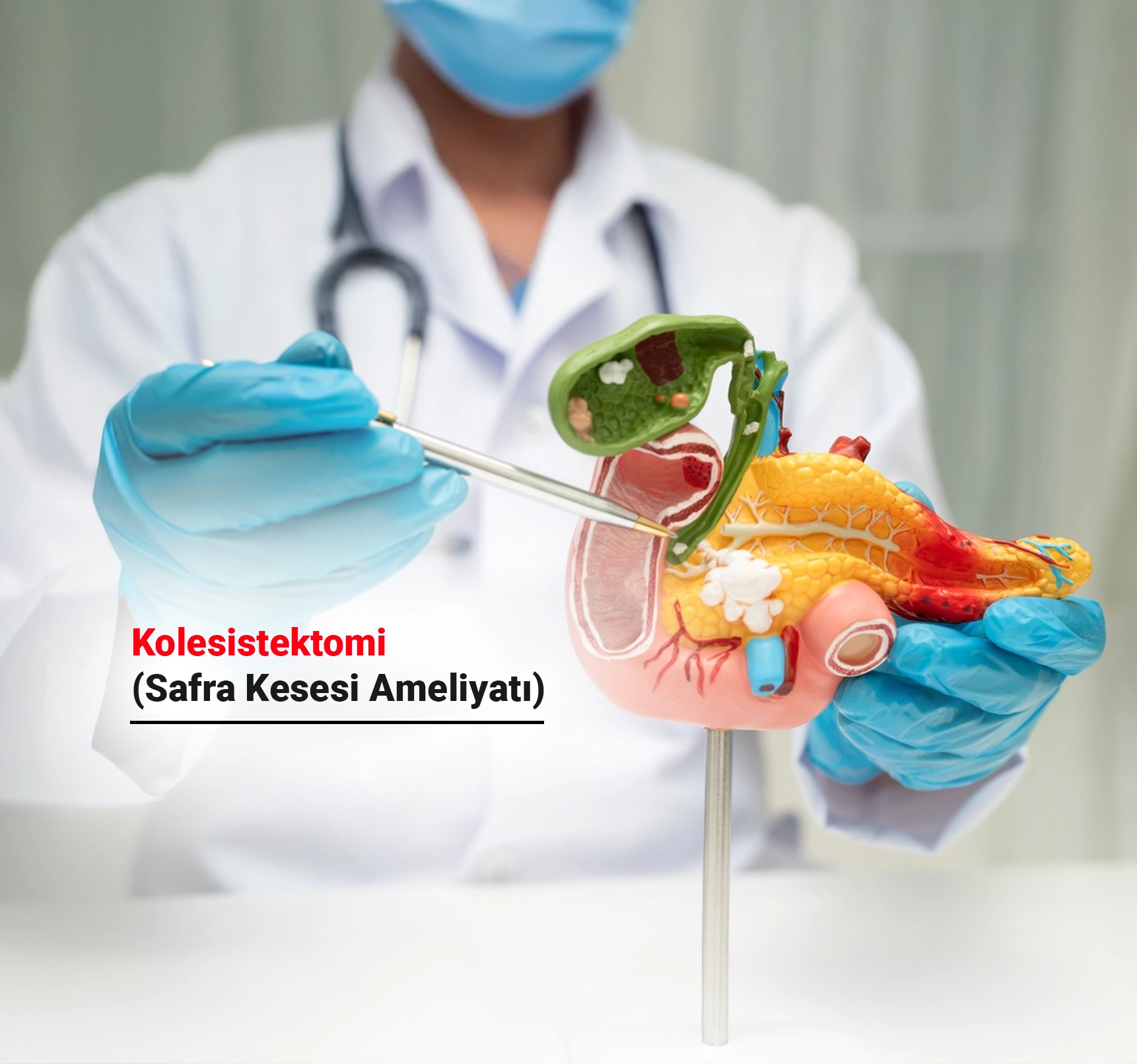 Kolesistektomi (Safra Kesesi Ameliyatı) Nedir? Neden Yapılır?