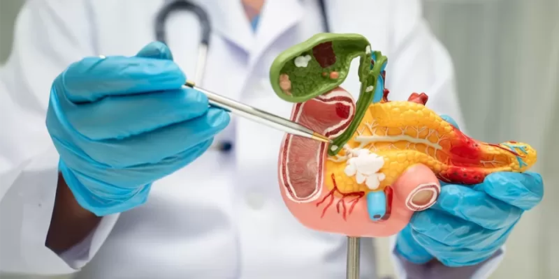What Is Cholecystectomy (Gallbladder Surgery)? Why Is It Performed?