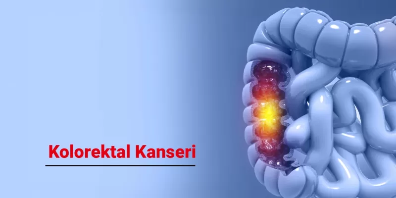 Kolorektal Kanseri Belirtileri ve Erken Tanı Yöntemleri