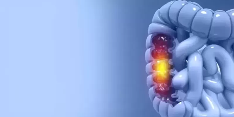 Colorectal Cancer Symptoms and Early Detection Methods