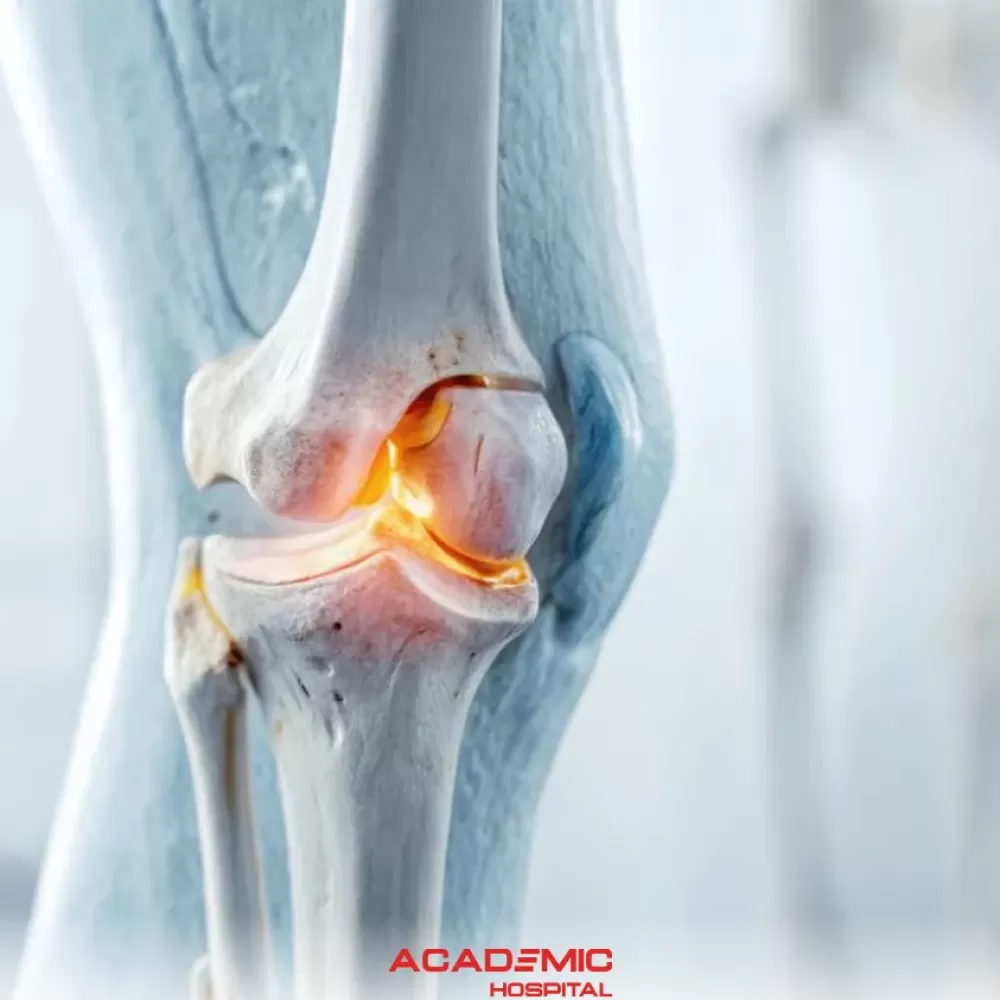 Kondromalazi Patella (Koşucu Dizi) Nedir? Belirtileri, Nedenleri ve Tedavi Yöntemleri