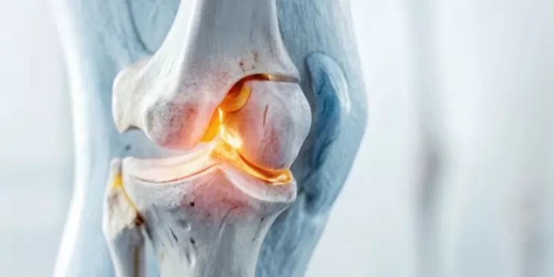 What Is Chondromalacia Patellae (Runner's Knee)? Symptoms, Causes, and Treatment Methods