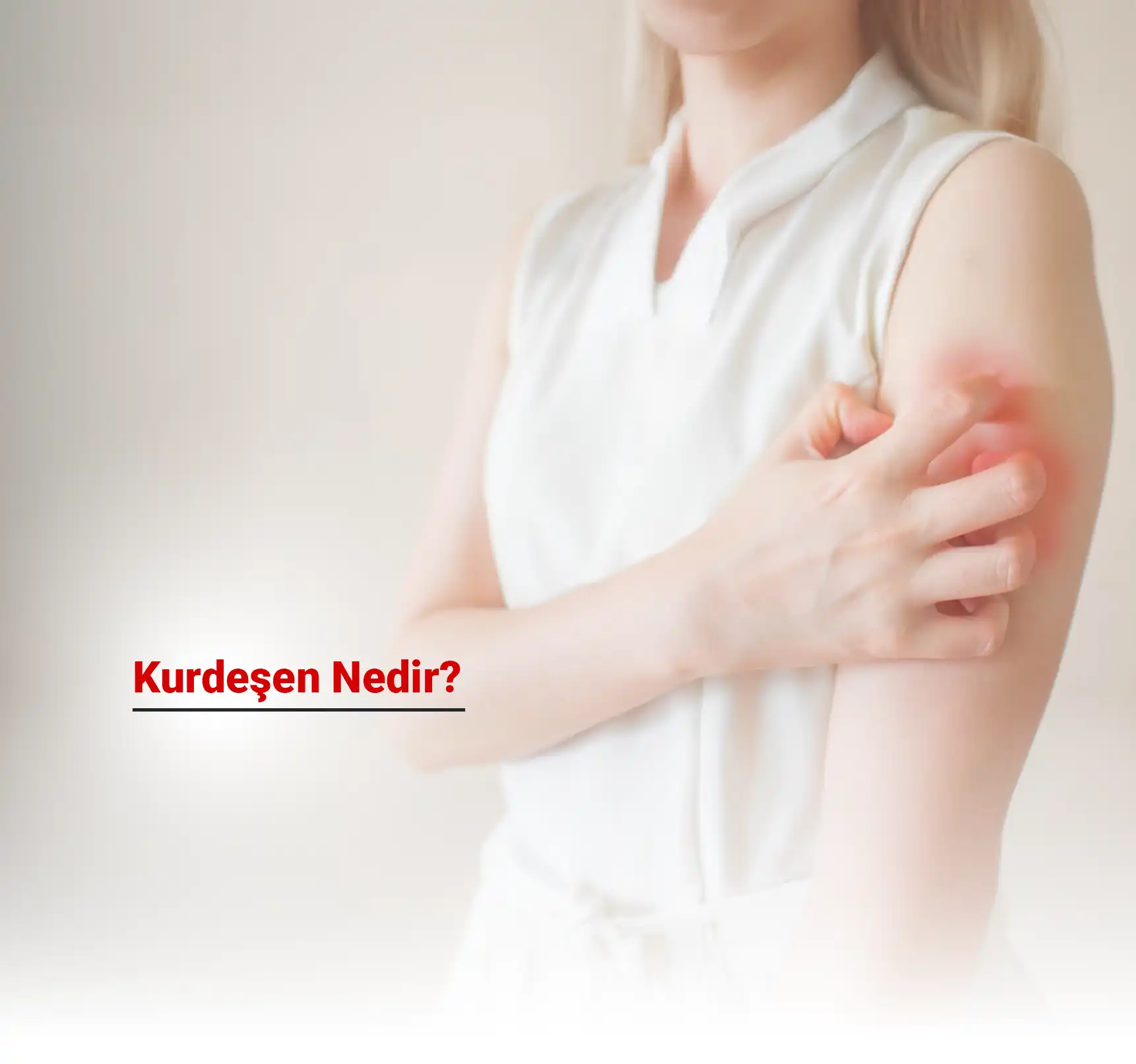 Kurdeşen Nedir?