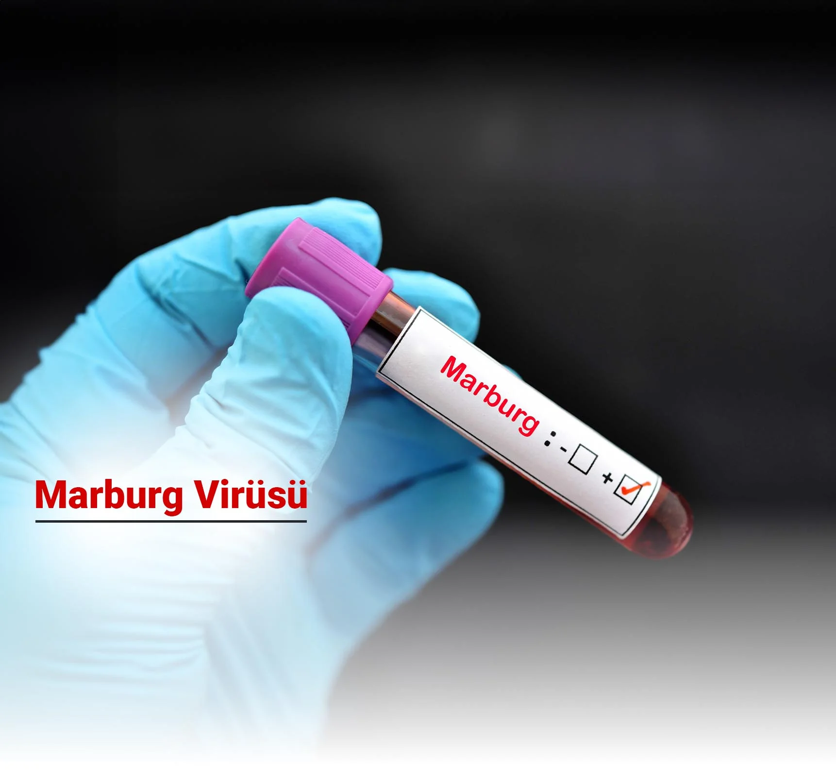 Marburg Virüsü Nedir? Belirtileri Nelerdir?