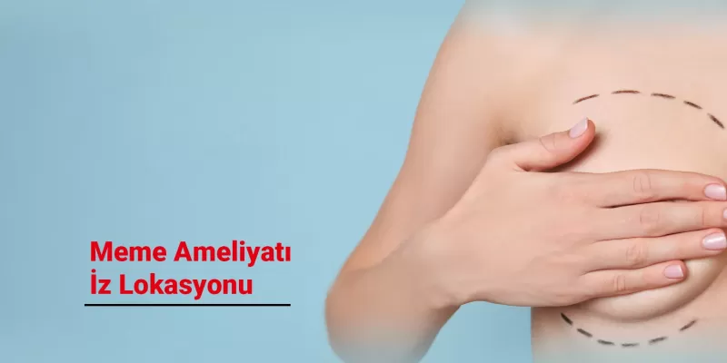 Meme Ameliyatı İz Lokasyonu: Nerede Olur, Nasıl Gizlenir?