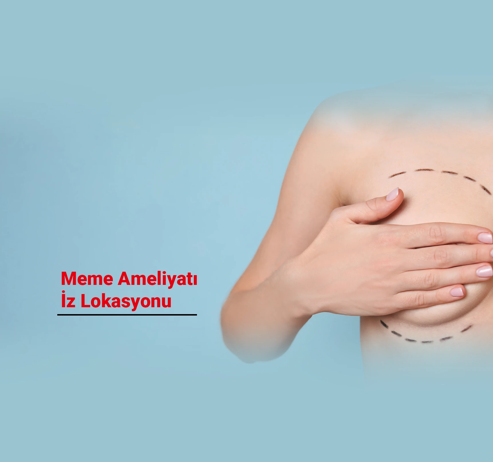 Meme Ameliyatı İz Lokasyonu: Nerede Olur, Nasıl Gizlenir?