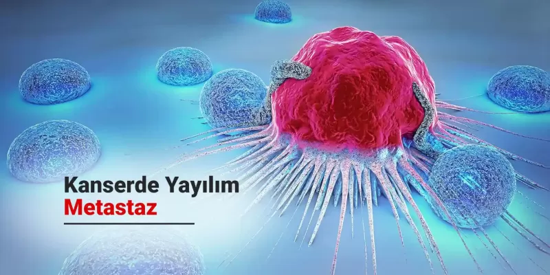 Kanser ve Kanserde Yayılım Durumu Metastaz (Sıçrama)