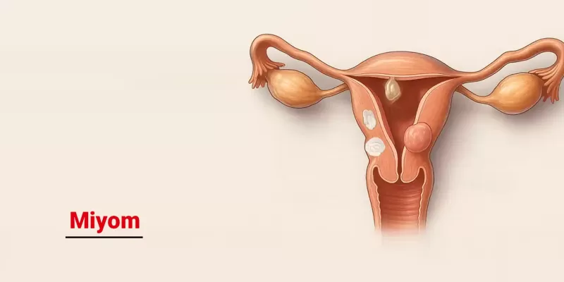 Miyom Nedir? Belirtileri, Nedenleri ve Tedavi Yöntemleri