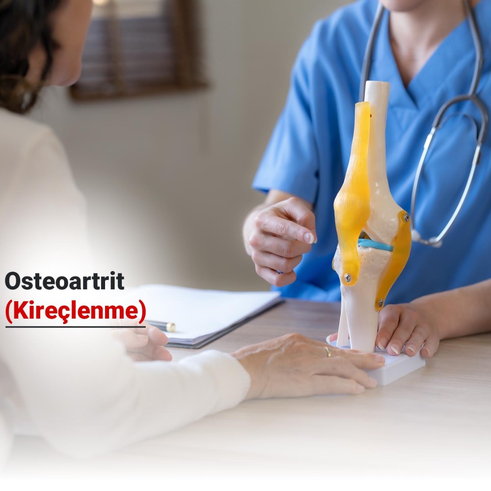 Osteoartrit (Kireçlenme) Nedir? Belirtileri ve Tedavi Yöntemleri Nelerdir?