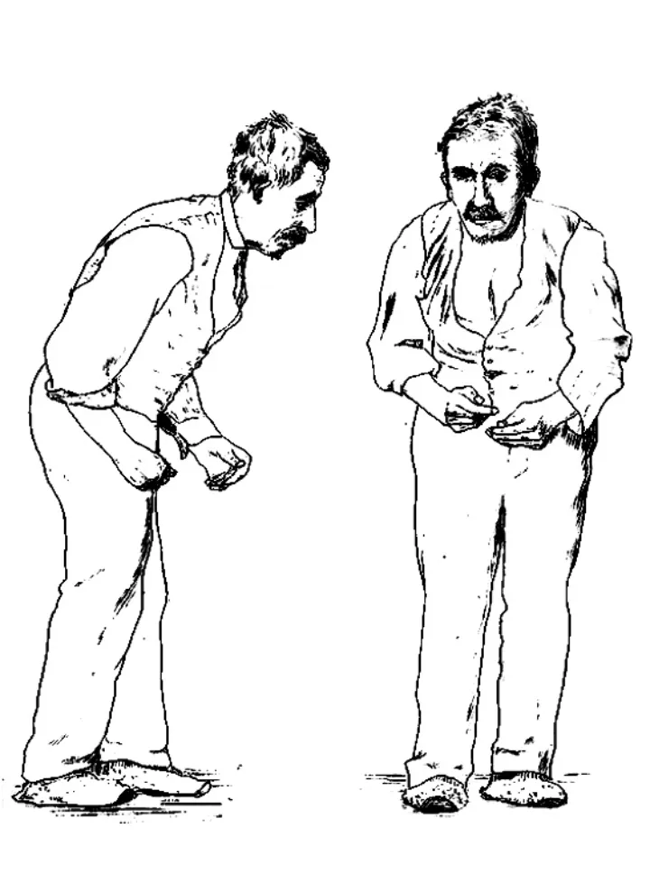 Parkinson